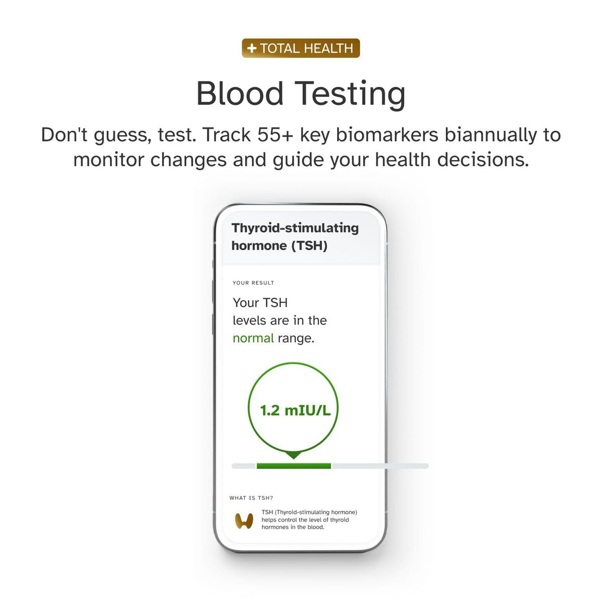 DNA Test Kit S26316