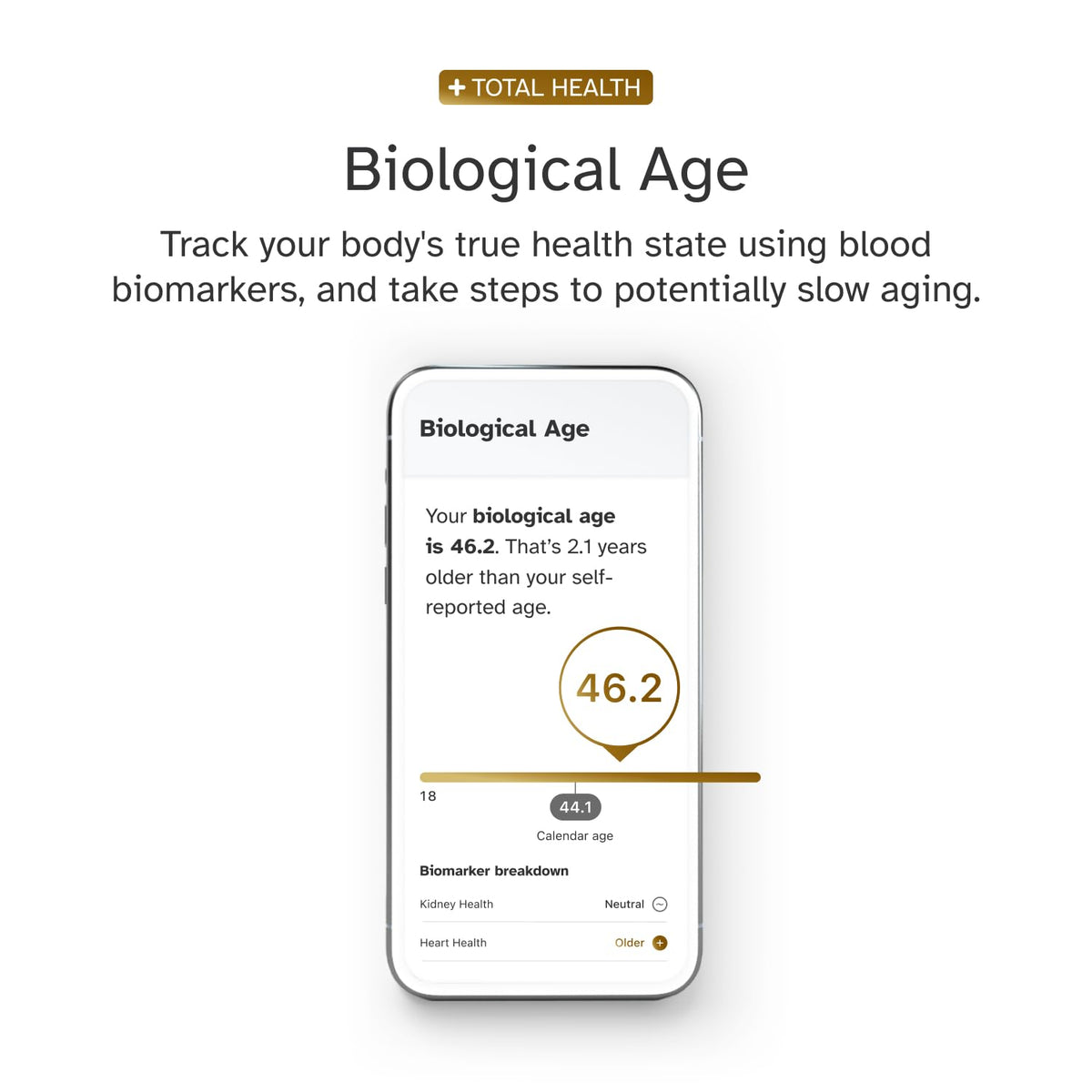 DNA Test Kit S26316